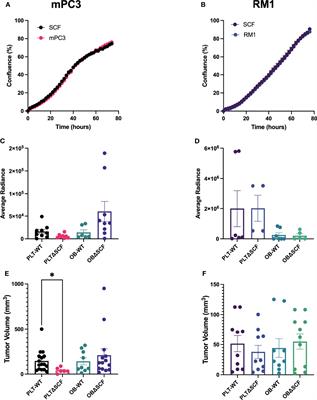 Bone Marrow-Derived Stem Cell Factor Regulates Prostate Cancer-Induced Shifts in Pre-Metastatic Niche Composition